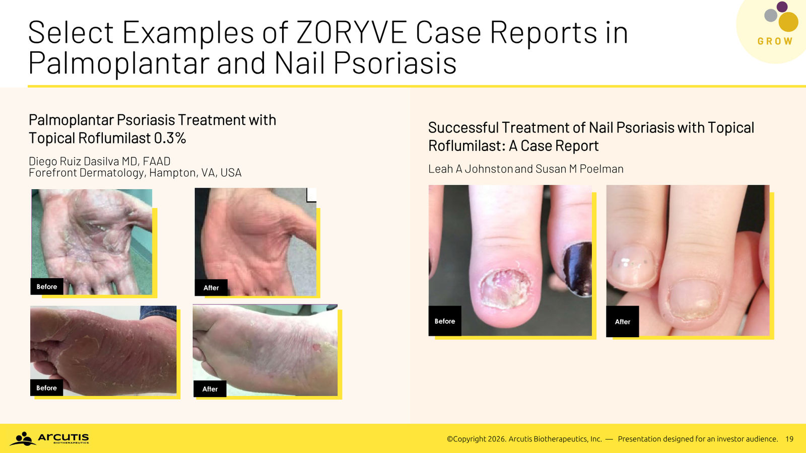 Arcutis Corporate Presentation — April 2026 — slide 19 of 28