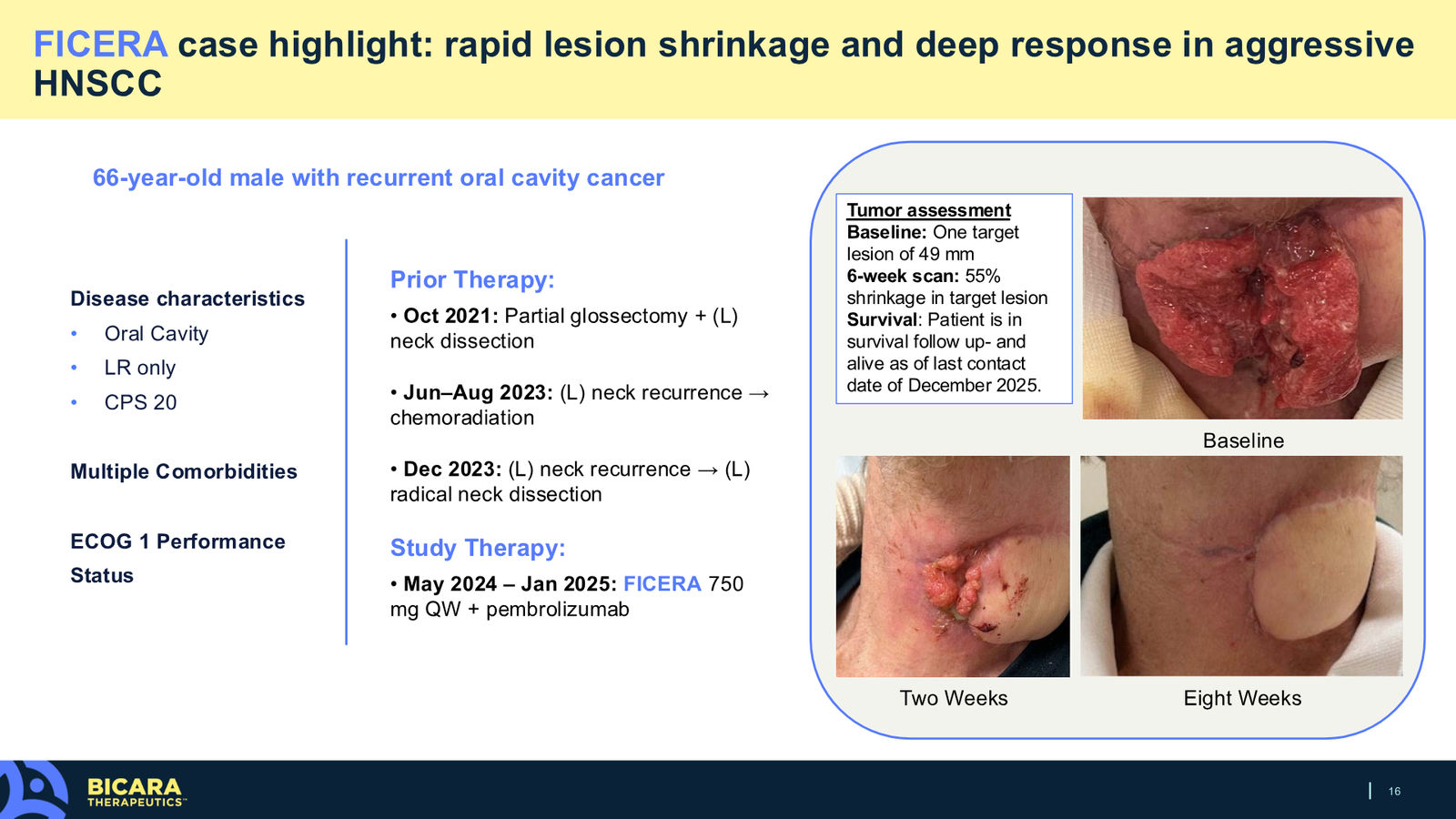 Bicara Therapeutics Corporate Presentation — slide 16 of 36