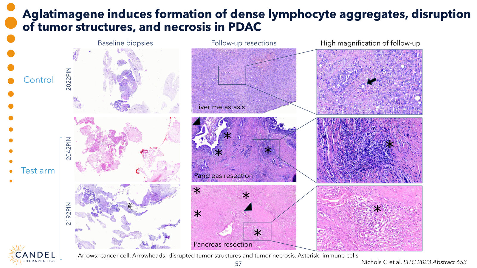 Candel Therapeutics Corporate Presentation — slide 58 of 73