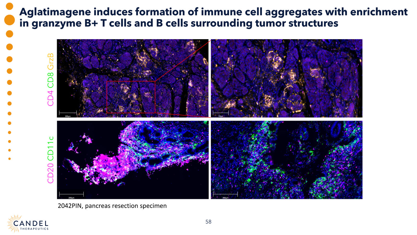 Candel Therapeutics Corporate Presentation — slide 59 of 73