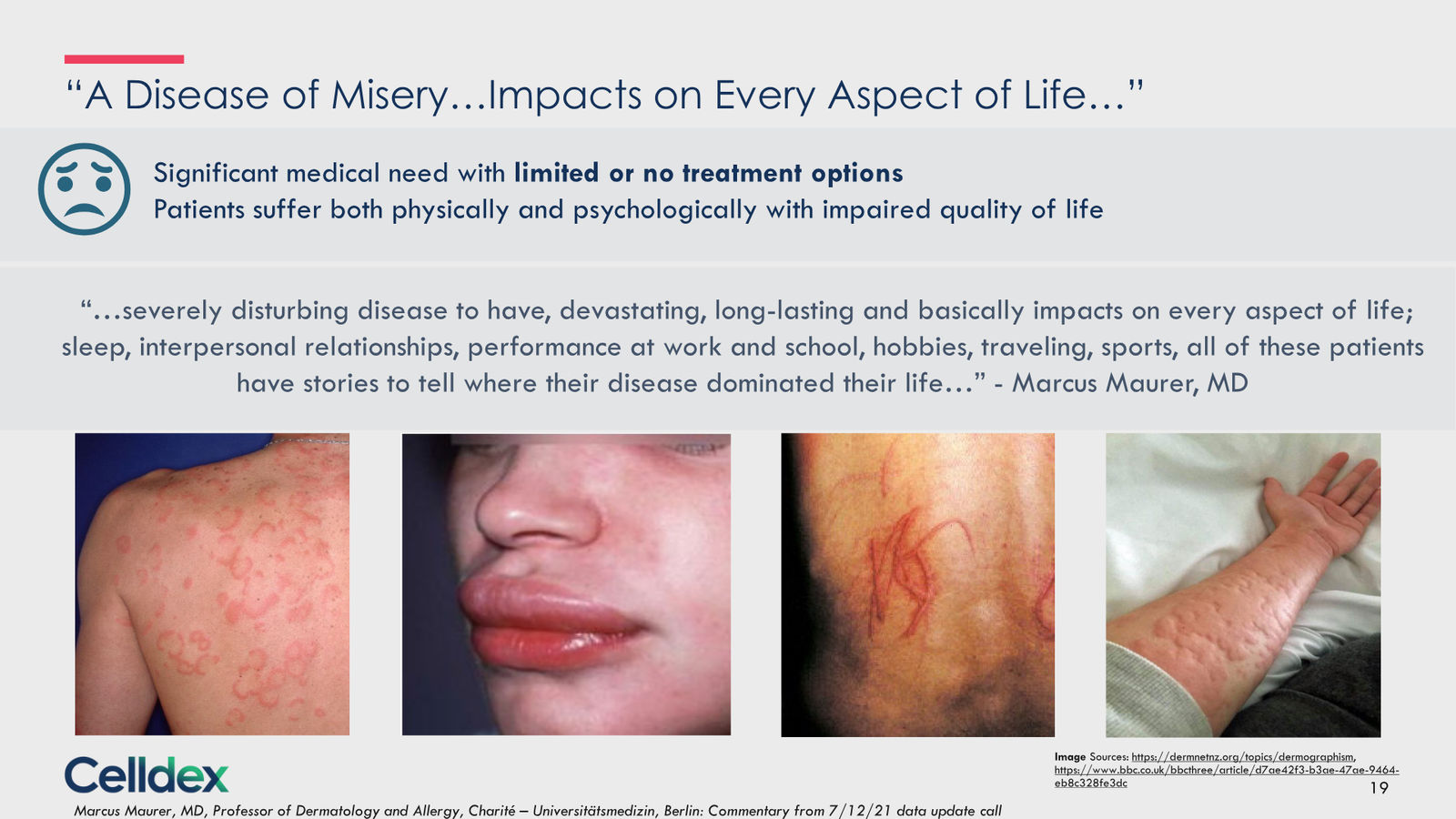 Pioneering new horizons in immunology to deliver life-changing therapies — slide 19 of 59