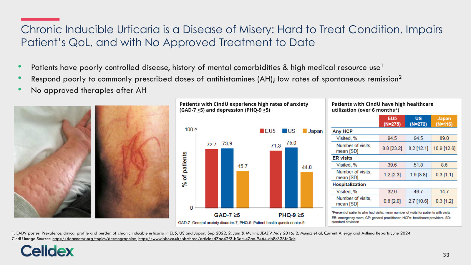 Pioneering new horizons in immunology to deliver life-changing therapies — slide 33 of 59