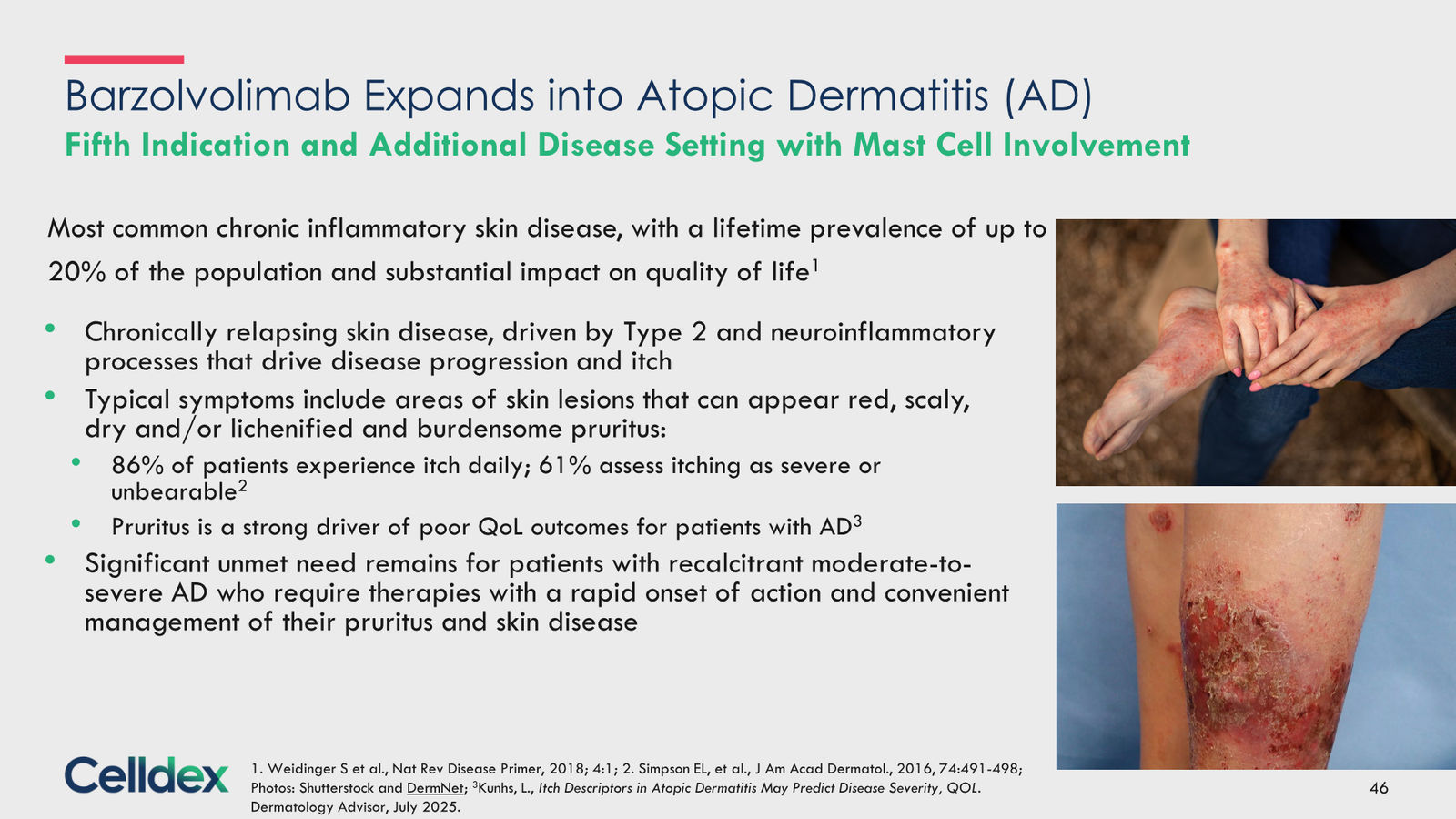 Pioneering new horizons in immunology to deliver life-changing therapies — slide 46 of 59