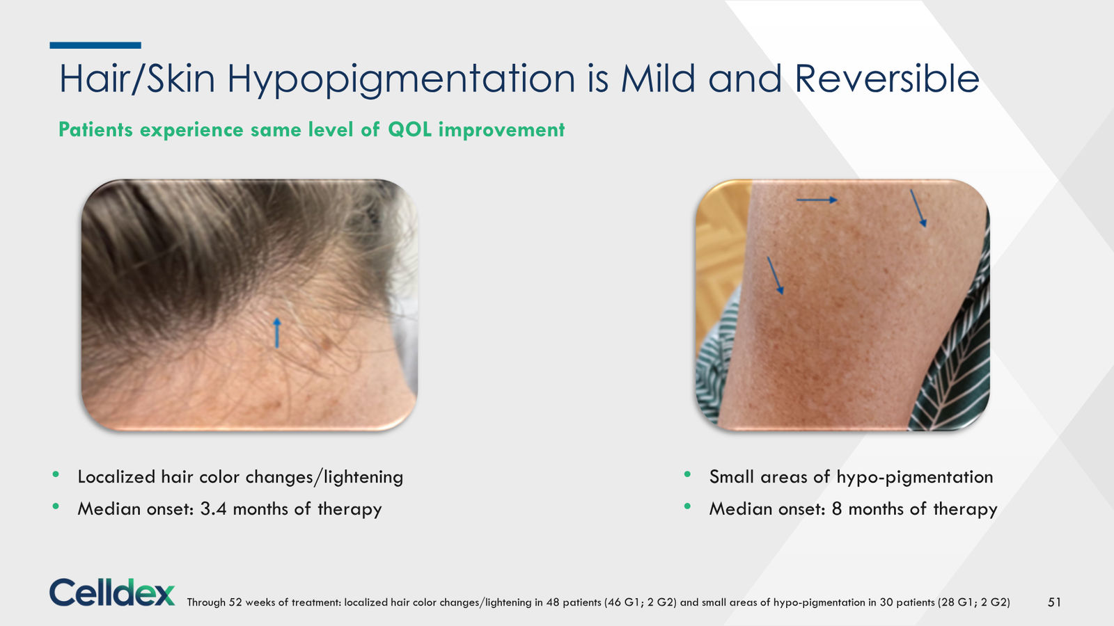 Pioneering new horizons in immunology to deliver life-changing therapies — slide 51 of 59