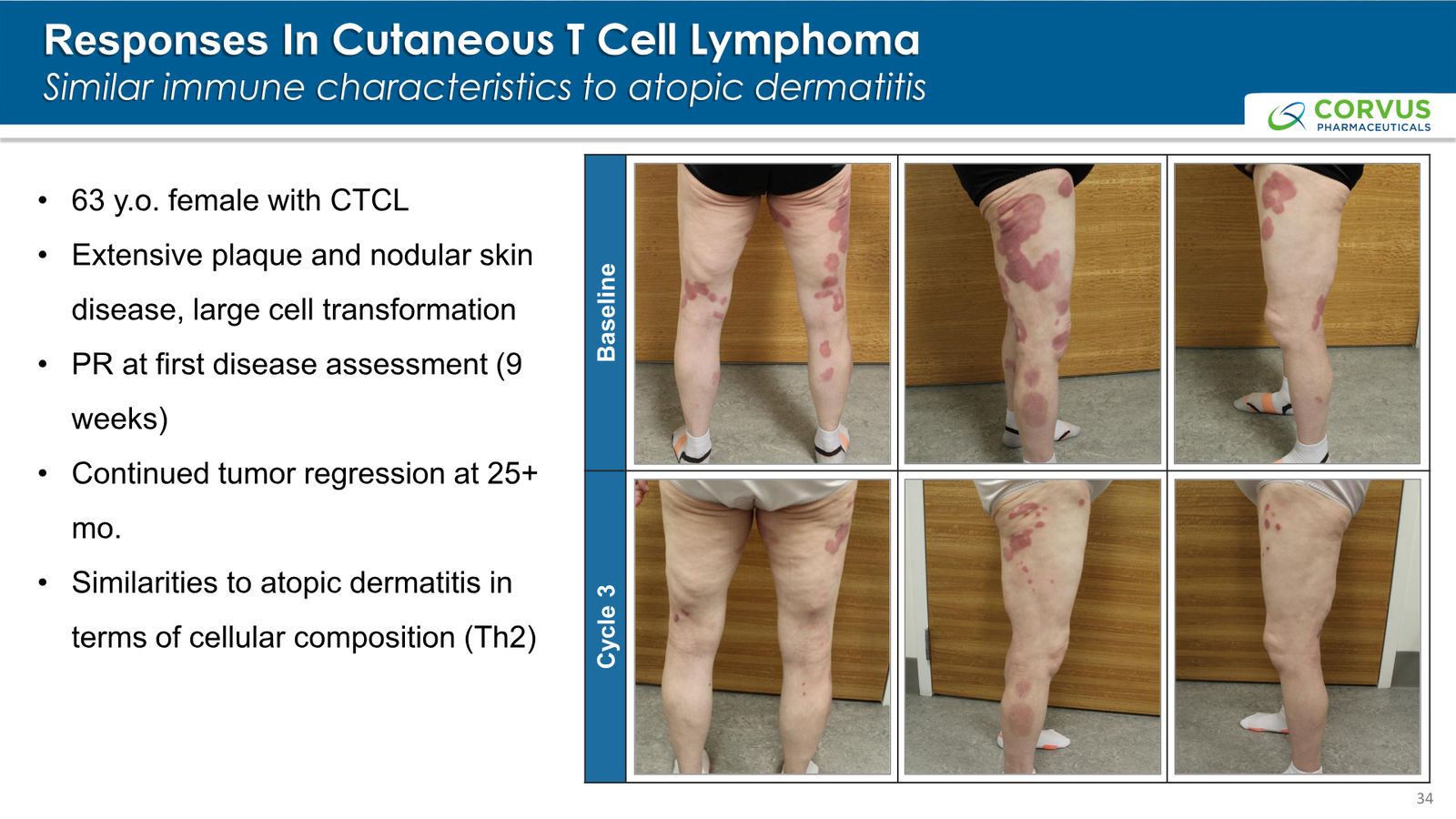Corvus Pharmaceuticals Corporate Presentation — slide 34 of 37