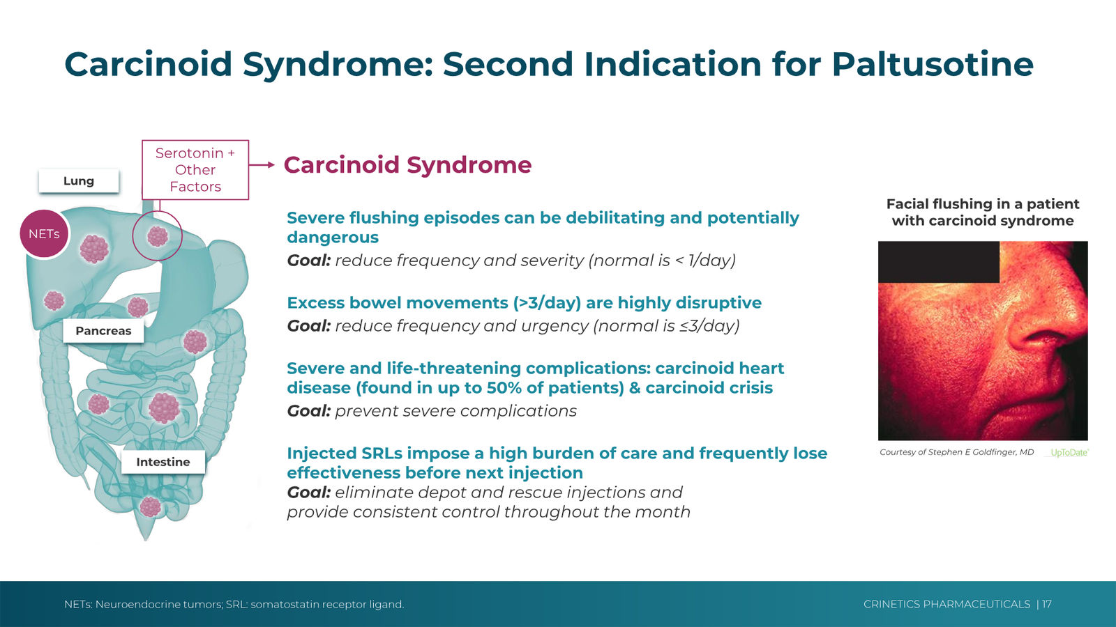 Crinetics Corporate Presentation February 2026 — slide 17 of 45