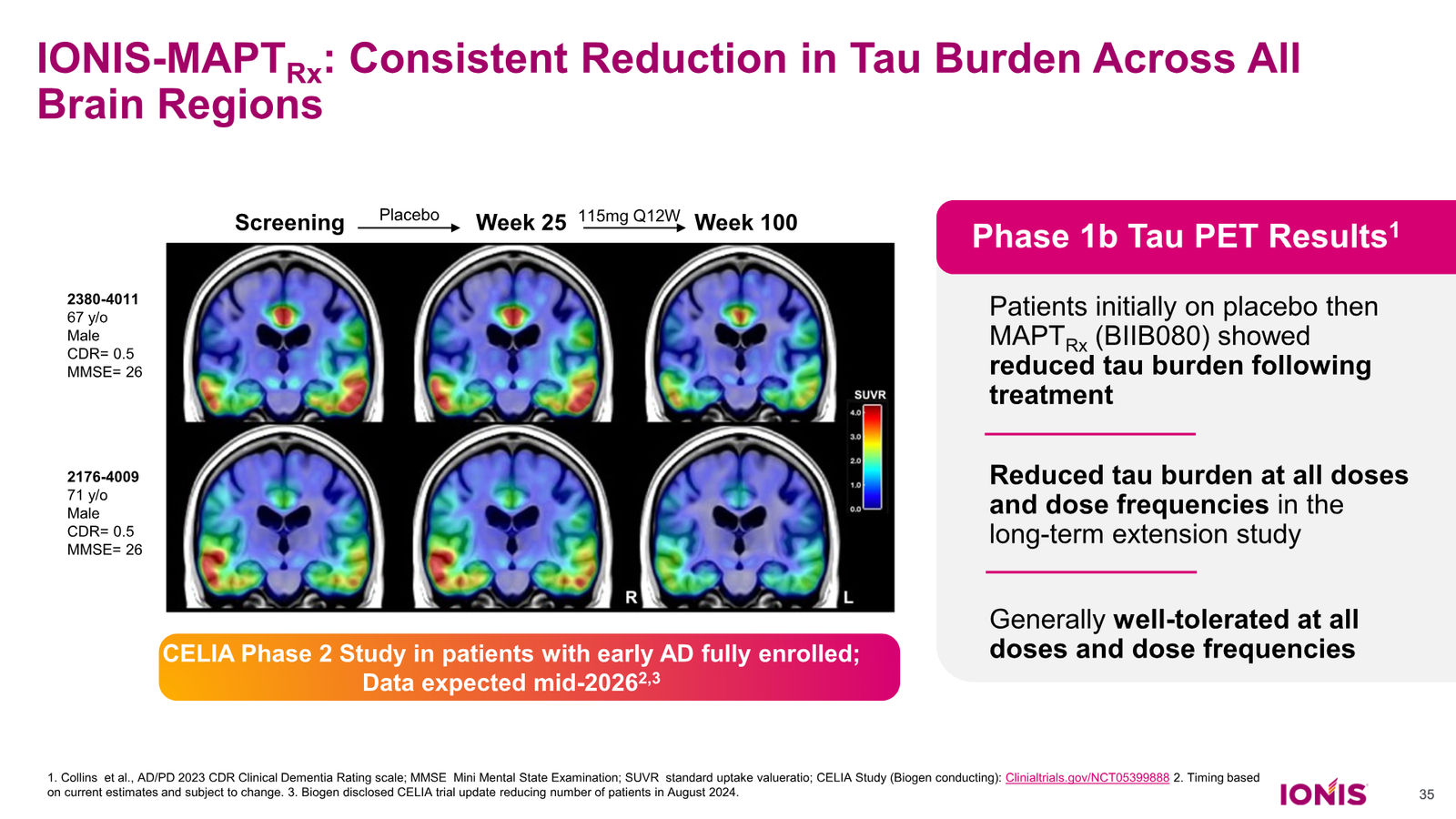 Ionis Corporate Presentation — slide 35 of 52