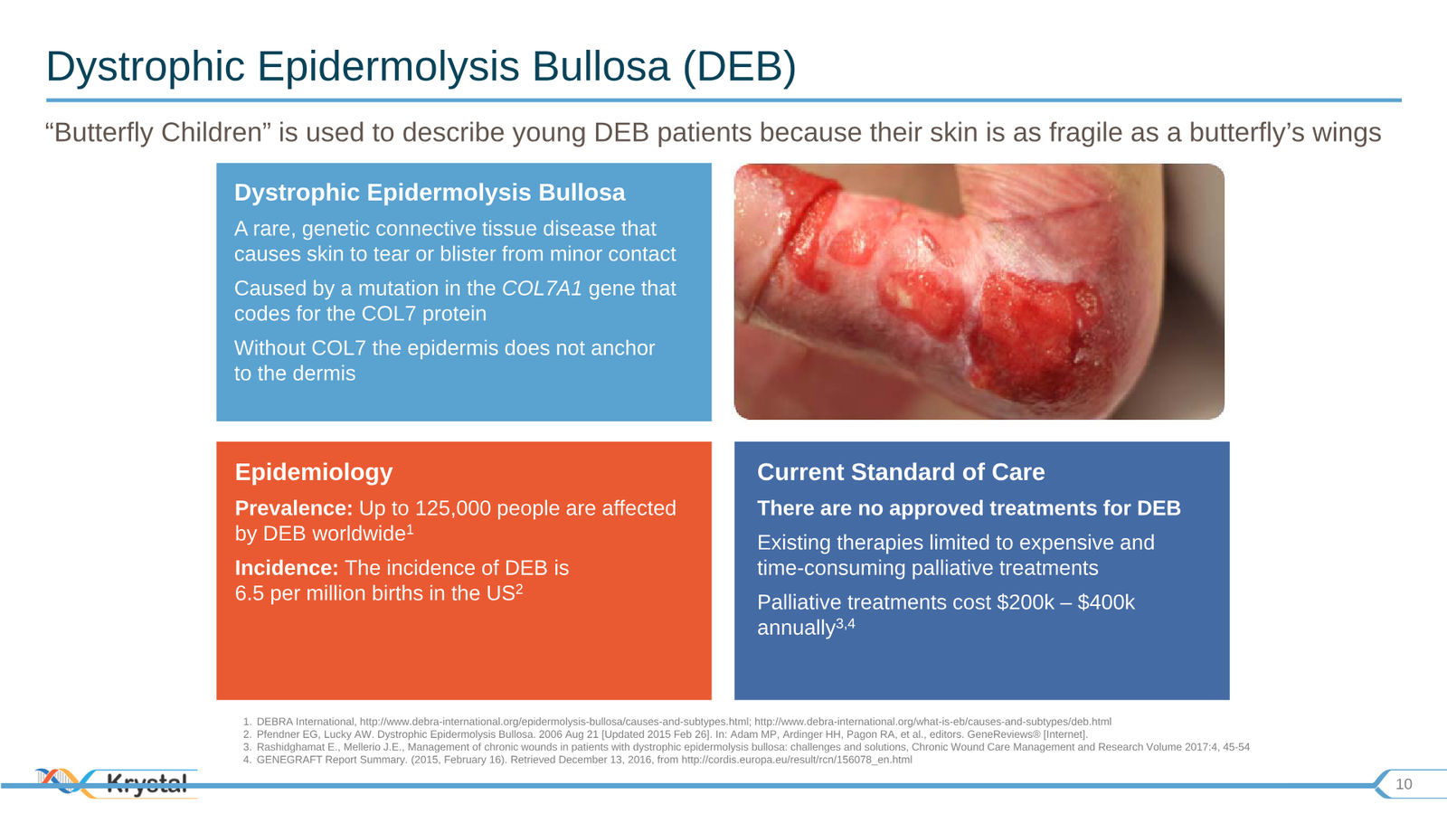 Krystal Biotech Corporate Presentation Q3 2019 — slide 10 of 43