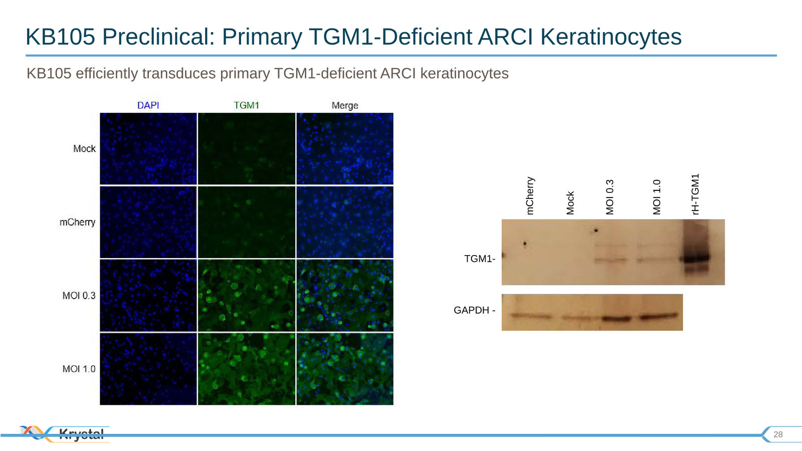 Krystal Biotech Corporate Presentation Q3 2019 — slide 28 of 43