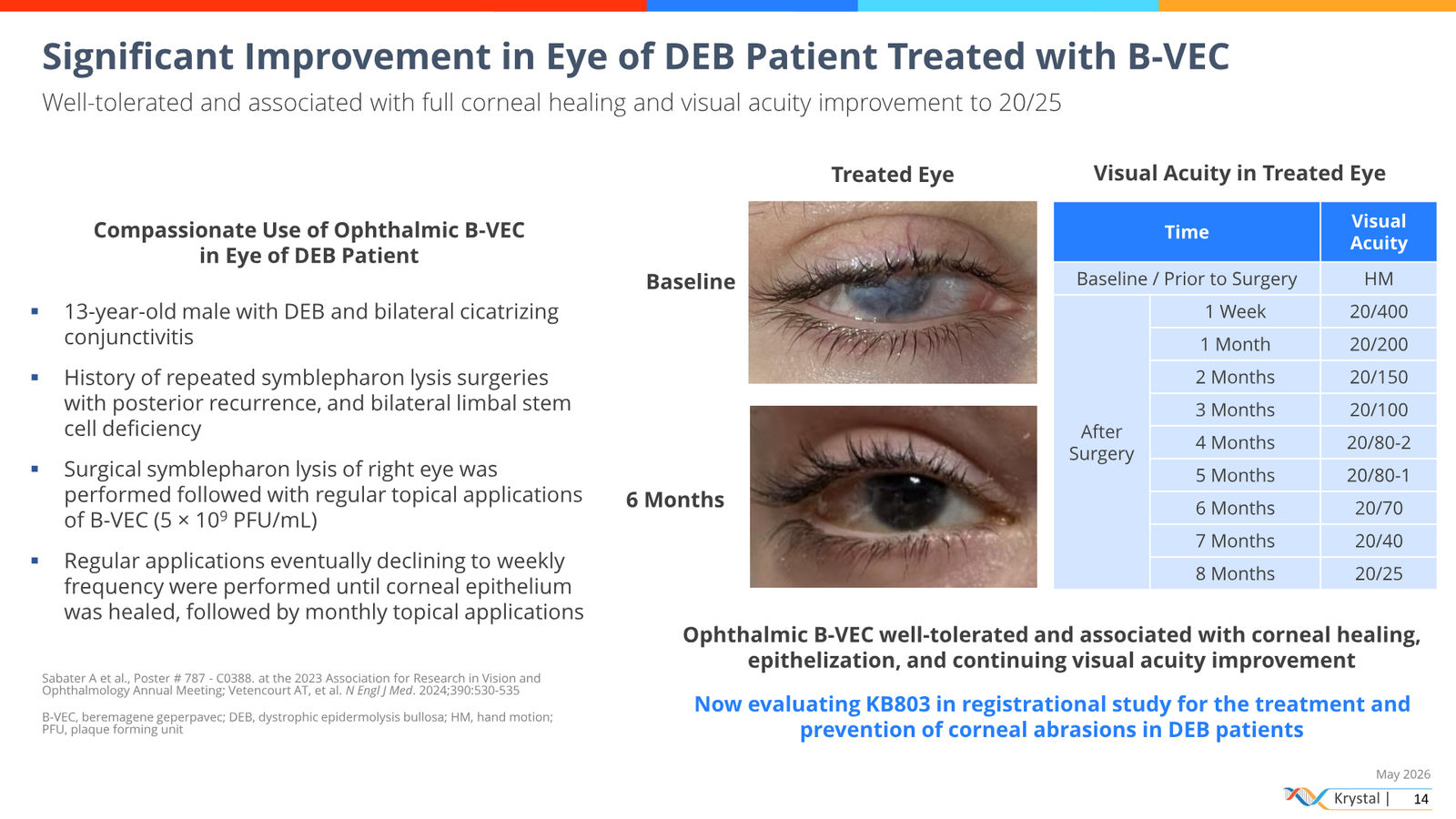 Krystal Biotech Corporate Presentation May 2026 — slide 14 of 51