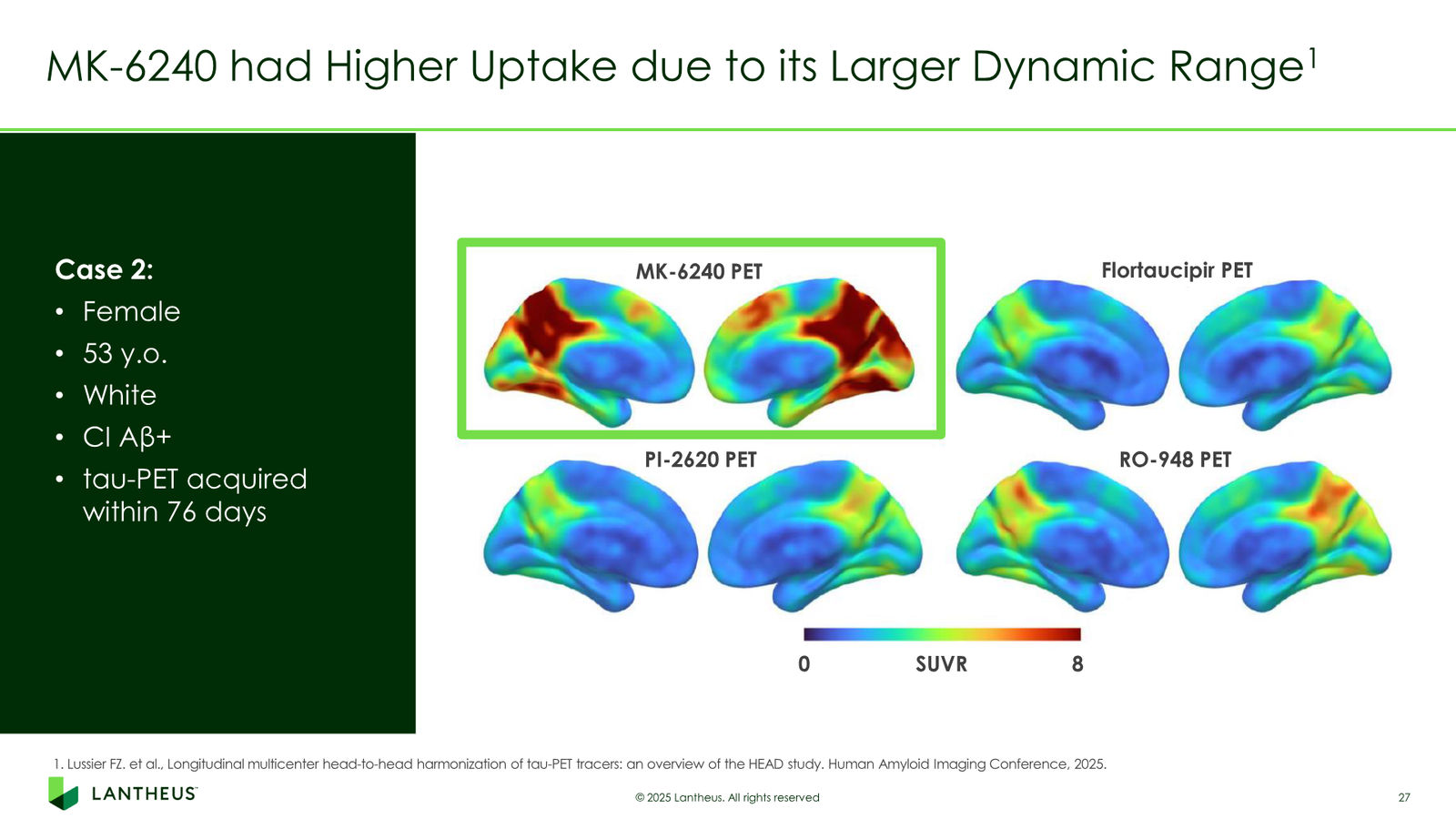 Lantheus Investor Presentation — slide 27 of 55