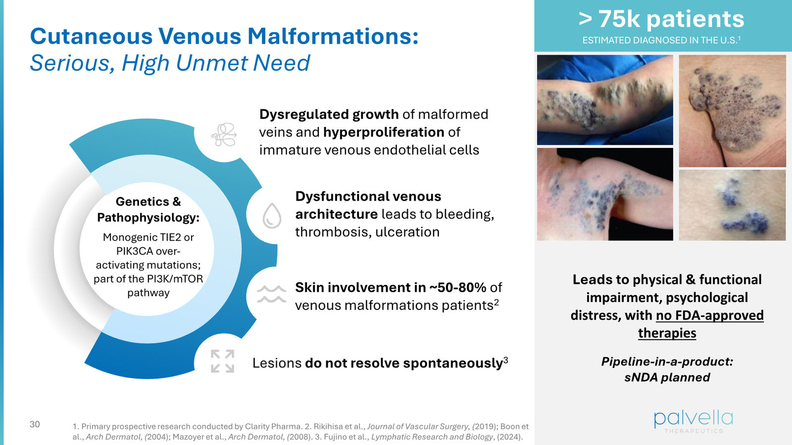 Palvella Therapeutics Corporate Presentation April 2026 — slide 30 of 48