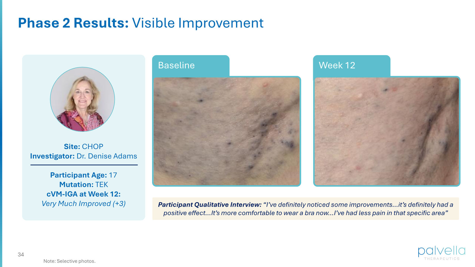 Palvella Therapeutics Corporate Presentation April 2026 — slide 34 of 48