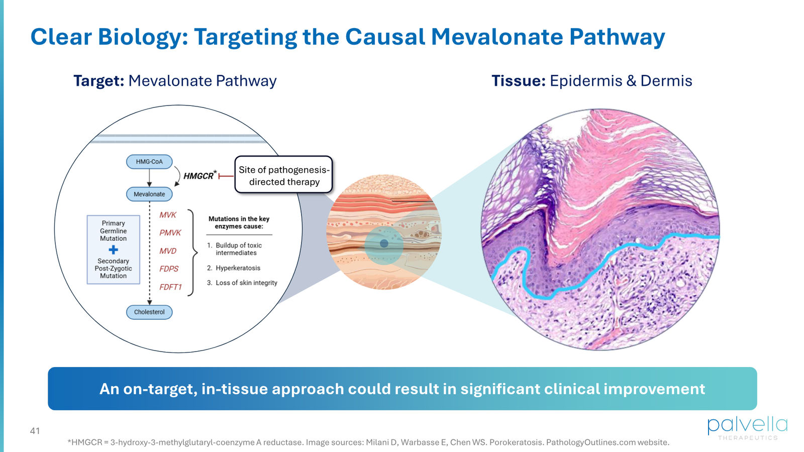 Palvella Therapeutics Corporate Presentation April 2026 — slide 41 of 48